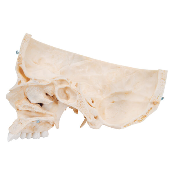 Модель черепа человека, материал BONElike™, 6 частей - 3B Smart Anatomy — изображение 6