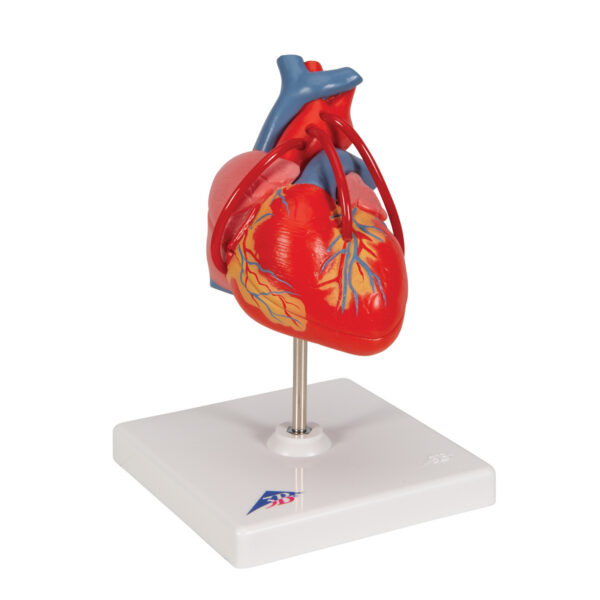 Классическая модель сердца с шунтом, 2 части - 3B Smart Anatomy — изображение 7