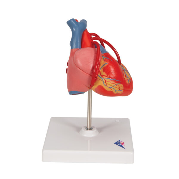 Классическая модель сердца с шунтом, 2 части - 3B Smart Anatomy — изображение 6