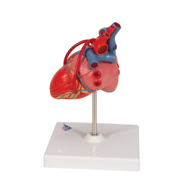 Классическая модель сердца с шунтом, 2 части - 3B Smart Anatomy — изображение 4