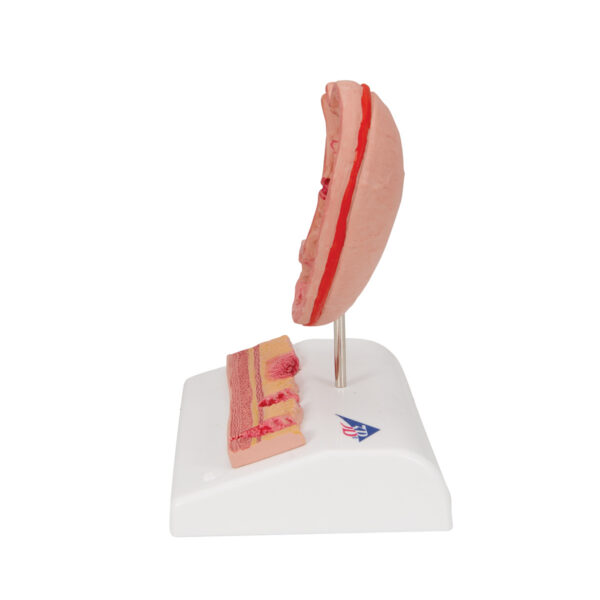 Модель желудка с язвами, 2 части - 3B Smart Anatomy — изображение 6