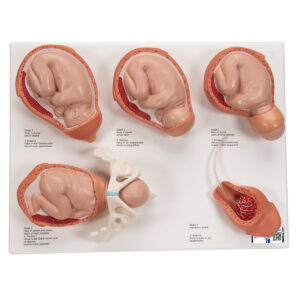 Модель стадий родов - 3B Smart Anatomy